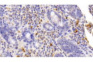 Detection of S100B in Bovine Small intestine Tissue using Polyclonal Antibody to S100 Calcium Binding Protein B (S100B) (S100B Antikörper  (AA 1-92))