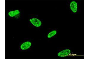 Immunofluorescence of monoclonal antibody to TP53RK on HeLa cell. (TP53RK Antikörper  (AA 154-253))