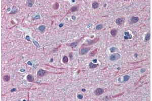 Human Brain, Cortex: Formalin-Fixed, Paraffin-Embedded (FFPE) (TUBB2A Antikörper  (AA 1-446))