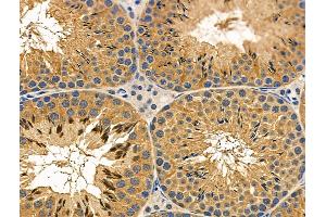 ABIN6257514 and ABIN6276058 at 1/100 staining Mouse testis tissue by IHC-P. (TACR1 Antikörper  (Internal Region))