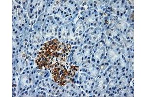 Immunohistochemical staining of paraffin-embedded Kidney tissue using anti-PLEKmouse monoclonal antibody. (Pleckstrin Antikörper)