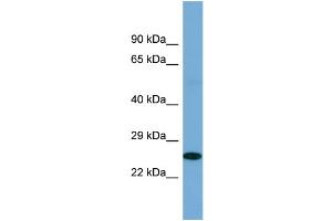 Host: Rabbit Target Name: POU2F3 Sample Type: Fetal Kidney lysates Antibody Dilution: 1. (POU2F3 Antikörper  (C-Term))