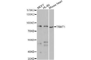 Western blot analysis of extracts of various cell lines, using TRMT1 antibody (ABIN5975089) at 1/1000 dilution. (TRMT1 Antikörper)