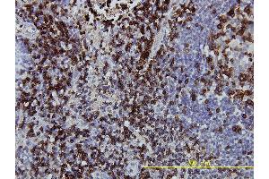 Immunoperoxidase of monoclonal antibody to CD3Z on formalin-fixed paraffin-embedded human lymph node tissue. (CD247 Antikörper  (AA 1-164))