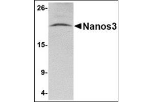 Western blot analysis of Nanos3 in human brain tissue lysate with this product at 2 μg/ml. (NANOS3 Antikörper  (C-Term))