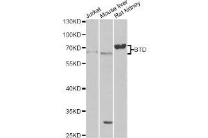 Western blot analysis of extracts of various cell lines, using BTD antibody (ABIN6290108) at 1:1000 dilution. (BTD Antikörper)