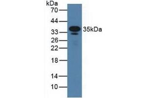 Detection of CD23 in Mouse Serum using Polyclonal Antibody to Cluster Of Differentiation 23 (CD23) (FCER2 Antikörper  (AA 150-330))