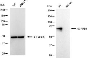 Western blotting analysis using SCARB1 antibody (ABIN7800276). (Rekombinanter SCARB1 Antikörper)