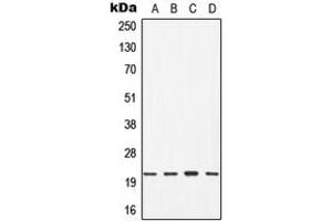 Western blot analysis of CDC42 expression in Jurkat (A), HT29 (B), mouse brain (C), rat liver (D) whole cell lysates.
