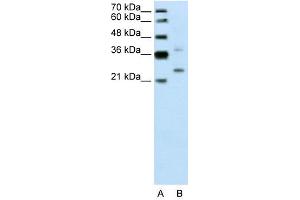 WB Suggested Anti-DCUN1D1  Antibody Titration: 0. (DCUN1D1 Antikörper  (N-Term))