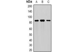 Western blot analysis of MEP1A expression in mouse intestine (A), mouse pancreas (B), rat kidney (C) whole cell lysates. (MEP1A Antikörper)