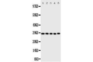 Western Blotting (WB) image for anti-Caspase 14, Apoptosis-Related Cysteine Peptidase (CASP14) (AA 223-242), (C-Term) antibody (ABIN3043977)