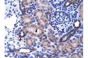 Image no. 1 for anti-Zinc Finger Protein 84 (ZNF84) (C-Term) antibody (ABIN202890)