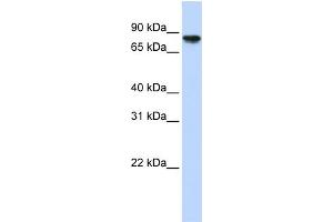 WB Suggested Anti-GYS2 Antibody Titration:  0. (Glycogen Synthase 2 Antikörper  (Middle Region))
