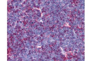 Anti-MAP3K7 / TAK1 antibody IHC of human thymus. (MAP3K7 Antikörper  (N-Term))