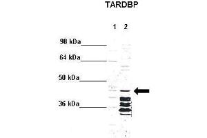 WB Suggested Anti-TARDBP Antibody  Positive Control: Lane 1: 5ug mouse brain cytoplasm Lane 2: 5ug mouse brain nucleus  Primary Antibody Dilution :  1:1000 Secondary Antibody : Anti rabbit - IR-dye Secondry Antibody Dilution :  1:10,000  Submitted by: Anonymous (TARDBP Antikörper  (N-Term))