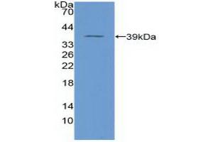 Detection of Recombinant NFkB, Human using Polyclonal Antibody to Nuclear Factor Kappa B (NFkB) (NFkB Antikörper  (AA 42-367))