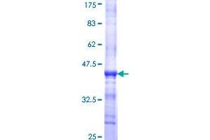 DCLK1 Protein (AA 640-729) (GST tag)