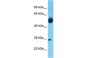 Host:  Rabbit  Target Name:  NR1H4  Sample Tissue:  Human Lung Tumor  Antibody Dilution:  1ug/ml (NR1H4 Antikörper  (N-Term))