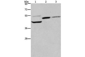 Western Blot analysis of Mouse heart, kidney and liver tissue using CYR61 Polyclonal Antibody at dilution of 1:350