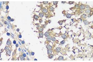 Immunohistochemistry of paraffin-embedded Rat testis using ASZ1 Polyclonal Antibody at dilution of 1:100 (40x lens). (ASZ1 Antikörper)