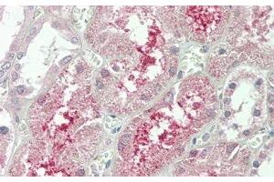Detection of KLb in Human Kidney Tissue using Polyclonal Antibody to Klotho Beta (KLb) (Klotho beta Antikörper  (AA 517-636))