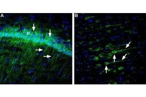 Expression of Neuroplastin in rat hippocampus and rat cortex - Immunohistochemical staining of free floating frozen section of rat hippocampal CA1 region (A) and posterior cingulate cortex (B) using Anti-Neuroplastin (extracellular) Antibody (ABIN7043382, ABIN7044710 and ABIN7044711), (1:120).
