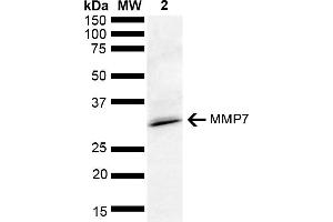 Western blot analysis of Rat kidney lysate showing detection of ~28 kDa MMP7 protein using Rabbit Anti-MMP7 Polyclonal Antibody (ABIN5651234). (MMP7 Antikörper  (AA 257-267) (Alkaline Phosphatase (AP)))