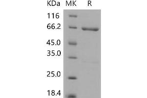 Western Blotting (WB) image for Mitogen-Activated Protein Kinase Kinase 4 (MAP2K4) protein (GST tag,His tag) (ABIN7320204) (MAP2K4 Protein (GST tag,His tag))