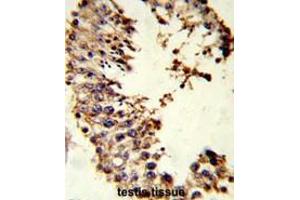 Formalin-fixed and paraffin-embedded human testis tissue reacted with ACR Antibody (Center), which was peroxidase-conjugated to the secondary antibody, followed by DAB staining.
