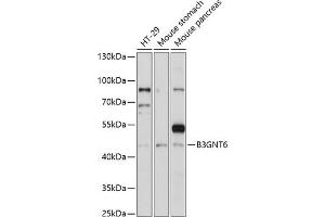 Western blot analysis of extracts of various cell lines, using B3GNT6 antibody (ABIN7271206) at 1:1000 dilution. (B3GNT6 Antikörper  (AA 30-200))