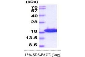 SDS-PAGE (SDS) image for Microtubule-Associated Protein 1 Light Chain 3 beta (MAP1LC3B) (AA 1-120) protein (His tag) (ABIN5854997)