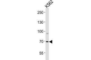 Western Blotting (WB) image for anti-Forkhead Box K1 (Foxk1) antibody (ABIN3004358)