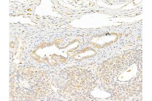 ABIN6255935 and ABIN6267312 at 1/100 staining Rat ovary tissue by IHC-P.
