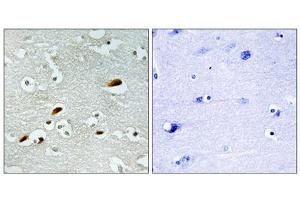 Immunohistochemistry analysis of paraffin-embedded human brain tissue, using TIP60 antibody. (KAT5 Antikörper  (Internal Region))