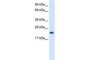 Western Blotting (WB) image for anti-High Mobility Group Box 3 (HMGB3) antibody (ABIN2461205) (HMGB3 Antikörper)