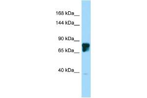 Host: Rabbit Target Name: SLITRK4 Sample Type: 721_B Whole Cell lysates Antibody Dilution: 1.