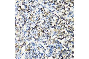 Immunohistochemistry (Paraffin-embedded Sections) (IHC (p)) image for anti-CD3 epsilon (CD3E) (AA 25-207) antibody (ABIN3022492)