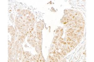 Immunohistochemistry (IHC) image for anti-Mediator Complex Subunit 1 (MED1) (C-Term) antibody (ABIN7453585) (MED1 Antikörper  (C-Term))