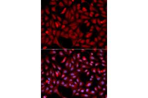 Immunofluorescence analysis of U2OS cell using SIAH1 antibody. (SIAH1 Antikörper  (AA 1-313))