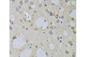 Immunohistochemistry of paraffin-embedded Mouse brain using YWHAZ Polyclonal Antibody at dilution of 1:100 (40x lens). (14-3-3 zeta Antikörper)