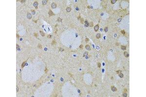 Immunohistochemistry of paraffin-embedded Mouse brain using YWHAZ Polyclonal Antibody at dilution of 1:100 (40x lens).