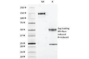 SDS-PAGE Analysis of Purified, BSA-Free S100 beta Antibody (clone S100B/1012). (S100B Antikörper)