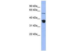 Image no. 1 for anti-RAD23 Homolog B (RAD23B) (AA 287-336) antibody (ABIN6744089) (RAD23B Antikörper  (AA 287-336))
