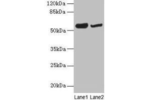 Western blot All lanes: NOSTRIN antibody at 6 μg/mL Lane 1: Mouse heart tissue Lane 2: Mouse brain tissue Secondary Goat polyclonal to rabbit IgG at 1/10000 dilution Predicted band size: 58, 55, 49, 65 kDa Observed band size: 58 kDa