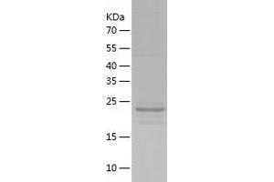 PAFAH1B3 Protein (AA 1-231) (His tag)