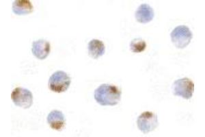Immunocytochemistry of Acinus in K562 cells with AP30012PU-N Acinus antibody at 5 μg/ml. (ACIN1 Antikörper  (Intermediate Domain))