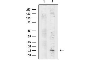anti-Cytidine Deaminase (CDA) (Internal Region) antibody