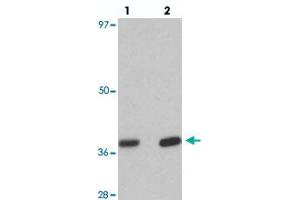 Western blot analysis of EI24 in rat liver tissue with EI24 polyclonal antibody  at (lane 1) 1 and (lane 2) 2 ug/mL. (EI24 Antikörper  (C-Term))