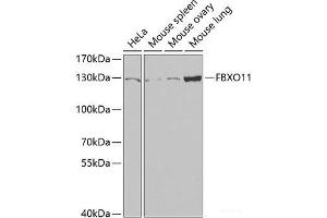 Western blot analysis of extracts of various cell lines using FBXO11 Polyclonal Antibody at dilution of 1:1000.